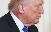 طفح جلدي على رقبة ترامب يثير تساؤلات… والطبيب يوضح