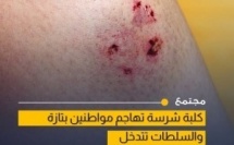 هجوم كلبة على مواطنين يثير القلق بمدينة تازة