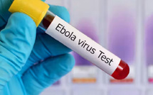 شفاء مريض من إيبولا في ألمانيا يسلّط الضوء على تطور العلاجات والبروتوكولات الطبية
